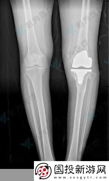 骨科新線路解析：為患者提供更便捷服務(wù)