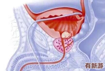手腳綁起來拿刷子刷尿道孔的行為背后隱藏著怎樣的心理與動機