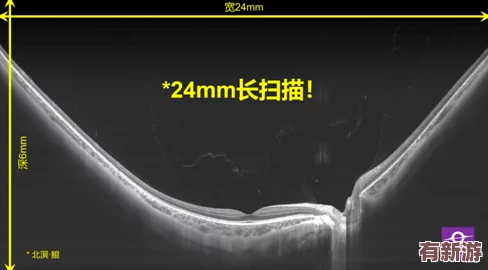 h136.vip紅桃視頻引發(fā)熱議