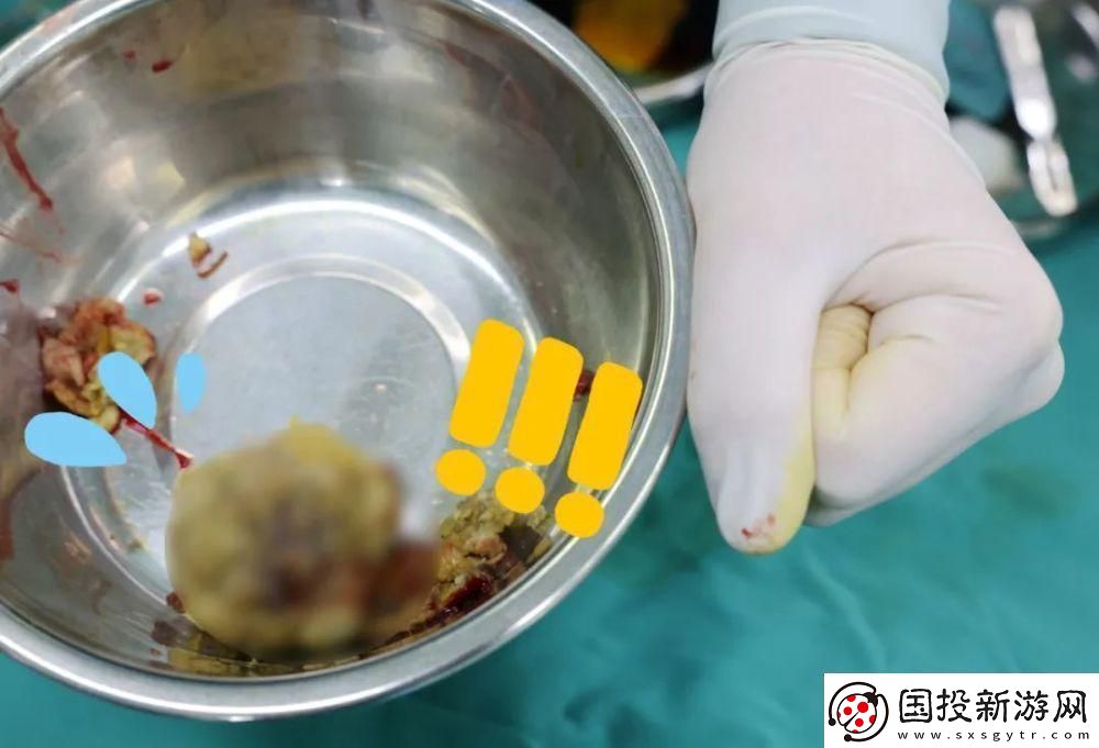 “腸”界翹楚拳頭“新星”：游戲界的另類傳奇