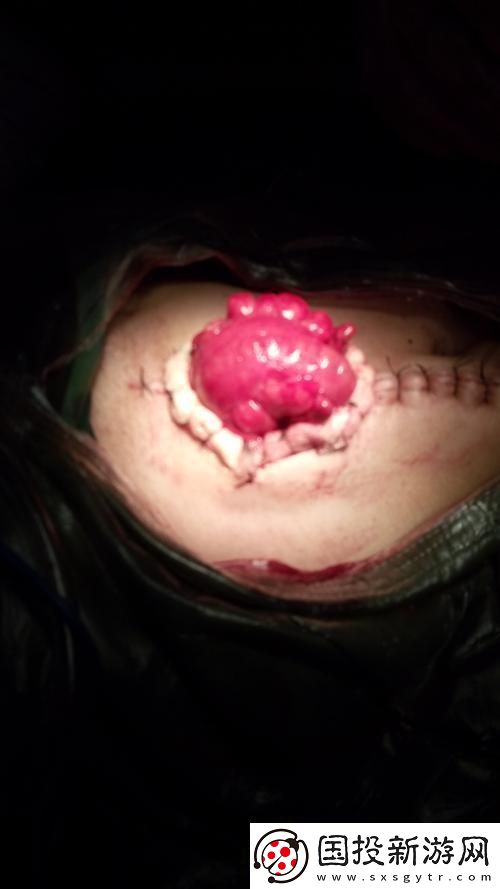 "痛點"里的狂潮-創(chuàng)新界的戲謔風云