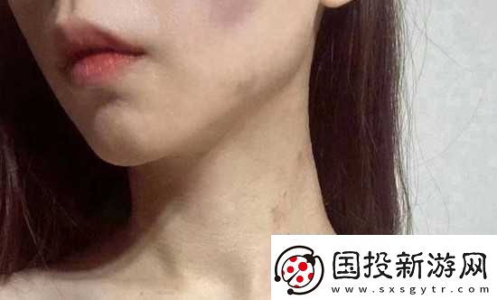 紅雅典娜LIYA死了嗎傳身體四分五裂是真的嗎