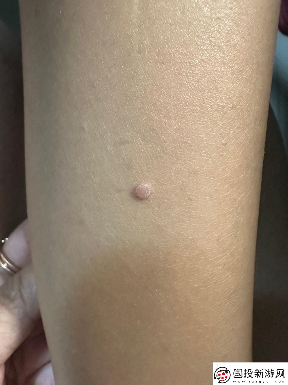 疙瘩里頭硬邦邦-友炒作風(fēng)頭勁