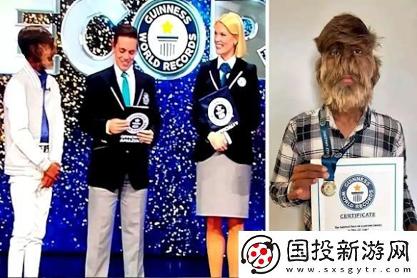 印度少年獲“最毛臉”吉尼斯紀(jì)錄-面部毛發(fā)覆蓋超95%